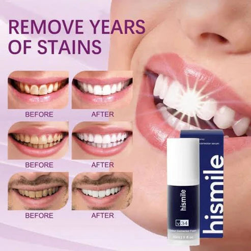 Hismile V34 Teeth Whitening Toothpaste